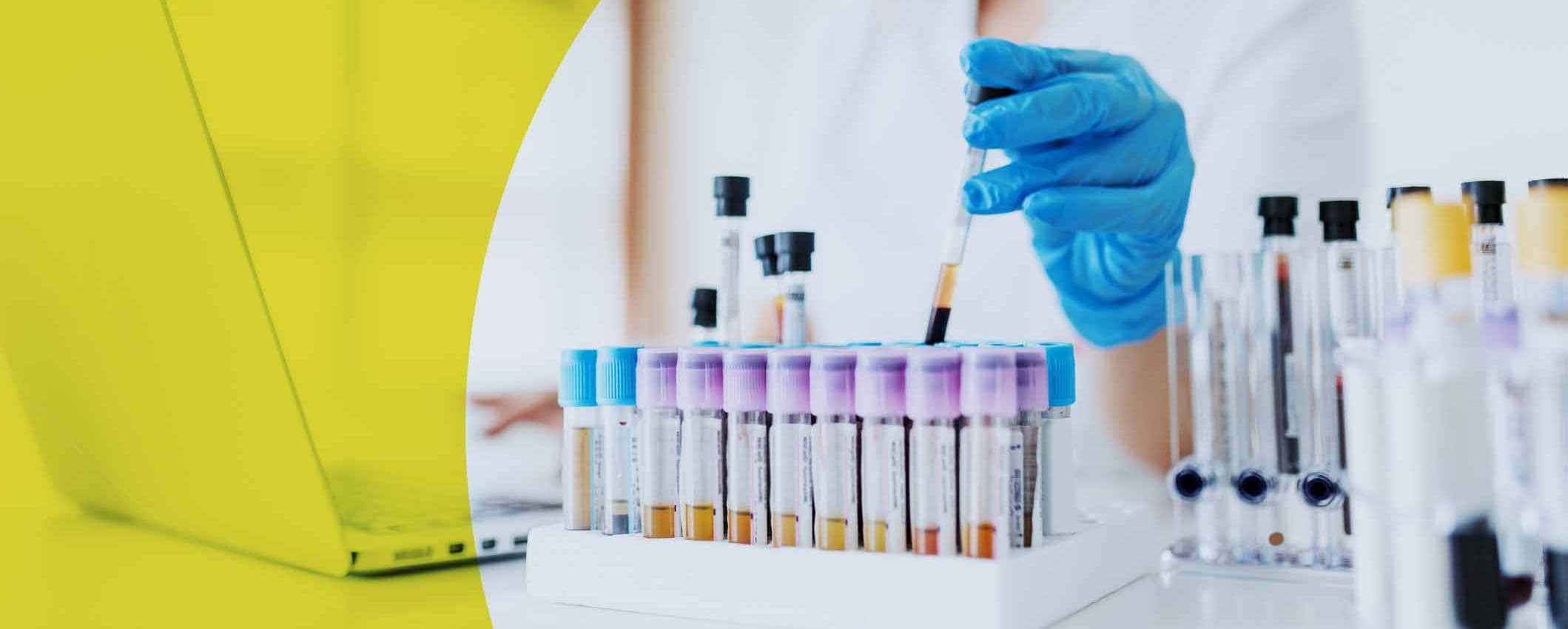 Medical tests before embarking on the process