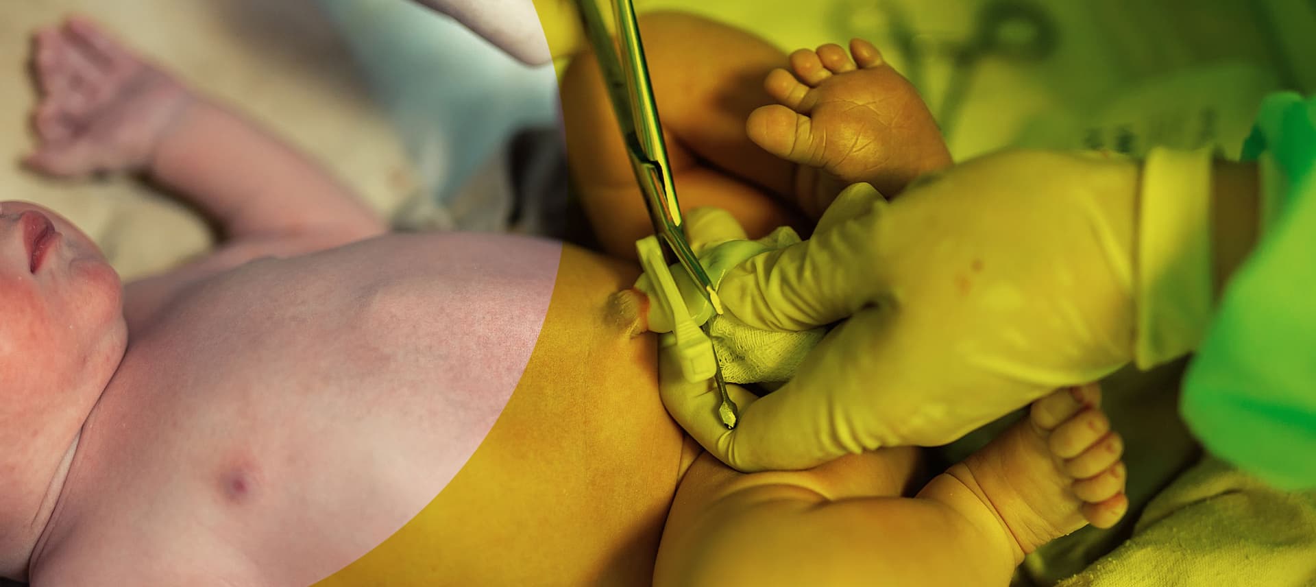 Cord blood - To save or not to save?